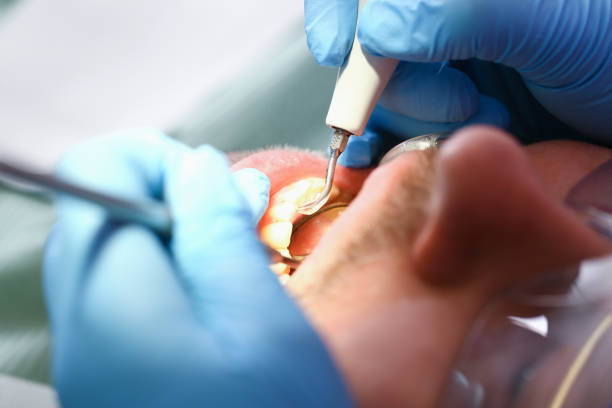 Best Emergency Denture Repair in Albion, MI