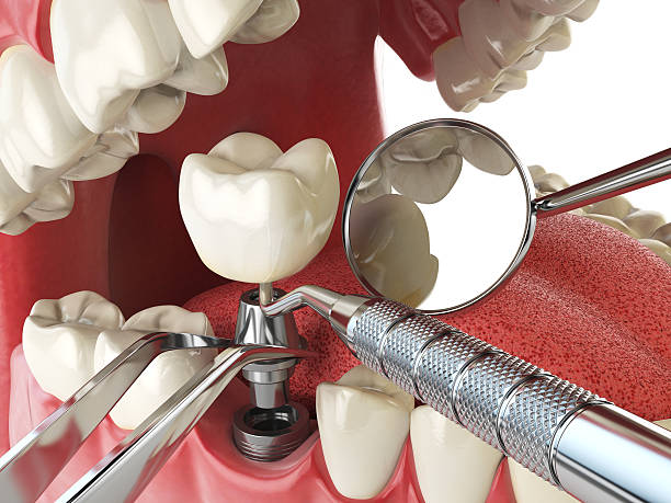 Professional Emergency Dental Service in MI